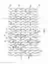 Fig. 07 - Method of increasing stent retention of bioabsorbable scaffolding with a sheath