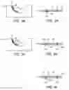 Fig. 05 - IMPROVEMENTS RELATING TO THE PRODUCTION OF WIND TURBINE COMPONENTS