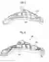 Fig. 04 - HYBRID LOWER ARM