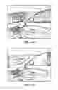 Fig. 12 - Shock-absorbing energy dissipation padding placed at eye level in an autonomous vehicle
