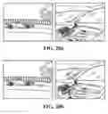 Fig. 16 - Autonomous vehicle having an external shock-absorbing energy dissipation padding