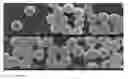 Fig. 09 - Bisphosphonates vinylic monomers and polymers and uses thereof