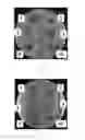 Fig. 02 - Antibacterial bismuth complexes