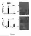 Fig. 03 - REGULATING IL-4 AND IL-13 LEVELS BY BLOCKING HIGH AFFINITY BINDING BY IL-3, IL-5 AND GM-CSF TO THEIR COMMON RECEPTOR