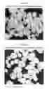 Fig. 07 - Spheroidal catalyst for olefin polymerization
