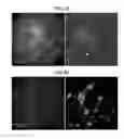 Fig. 06 - Method for inducing differentiation of neural crest cells into neurons of the autonomic nervous system