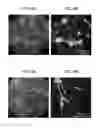 Fig. 12 - Method for inducing differentiation of neural crest cells into neurons of the autonomic nervous system