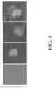 Fig. 02 - Neural progenitor cell differentiation