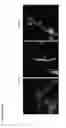 Fig. 06 - Means and methods for generation of breast stem cells