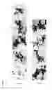 Fig. 10 - Means and methods for generation of breast stem cells