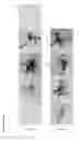 Fig. 13 - Means and methods for generation of breast stem cells