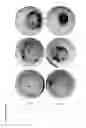 Fig. 25 - Means and methods for generation of breast stem cells