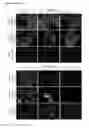 Fig. 33 - Means and methods for generation of breast stem cells
