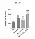 Fig. 09 - METHOD FOR PREPARING NATURAL KILLER CELLS USING IRRADIATED PBMCS, AND ANTI-CANCER CELL THERAPEUTIC AGENT COMPRISING THE NK CELLS