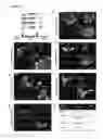 Fig. 09 - Methods and compositions for converting non-endocrine pancreatic tissue into insulin-producing cells