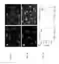 Fig. 02 - Methods of reducing or preventing intimal damage caused by mechanical stimulation of endothelial cells