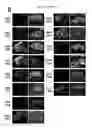 Fig. 35 - Methods and compositions for translational profiling and molecular phenotyping