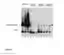 Fig. 04 - Assay system to identify HPV replication inhibitors in HT-screen