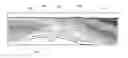 Fig. 01 - Portable fabric cutting device