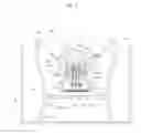 Fig. 06 - Solution supply