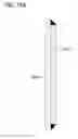 Fig. 65 - Long span masonry lintel support system