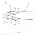 Fig. 05 - Turbine engine part with non-axisymmetric surface