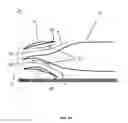 Fig. 06 - Turbine engine part with non-axisymmetric surface