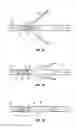 Fig. 06 - Ballistic arrow