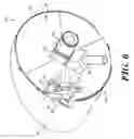 Fig. 07 - Case orientation device