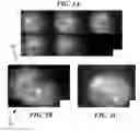 Fig. 06 - Method and apparatus for obtaining a three-dimensional map of tympanic membrane thickness