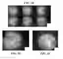 Fig. 07 - Method and apparatus for obtaining a three-dimensional map of tympanic membrane thickness