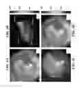 Fig. 08 - Method and apparatus for obtaining a three-dimensional map of tympanic membrane thickness