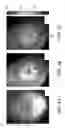 Fig. 09 - Method and apparatus for obtaining a three-dimensional map of tympanic membrane thickness