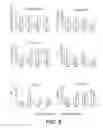 Fig. 09 - METHOD OF DETECTION OF OCCULT PANCREATIC BETA CELL DYSFUNCTION IN NORMOGLYCEMIC PATIENTS