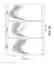 Fig. 23 - METHOD OF DETECTION OF OCCULT PANCREATIC BETA CELL DYSFUNCTION IN NORMOGLYCEMIC PATIENTS
