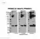 Fig. 08 - Optimizing diagnostics for galactofuranose containing antigens