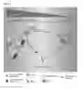Fig. 02 - METHOD FOR TREATING HIGH-GRADE GLIOMAS