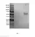 Fig. 06 - COMPOSITIONS AND METHODS FOR DIAGNOSIS OF AUTISM SPECTRUM DISORDER