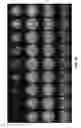 Fig. 71 - Electromagnetic shielding for magnetic resonance imaging methods and apparatus