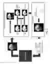 Fig. 04 - Systems and methods for automatic voxel positioning in magnetic resonance spectroscopy