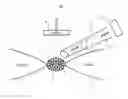 Fig. 01 - Optical device and use of the device