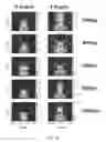 Fig. 40 - Subwavelength structured lens having moire pattern, use and methods of making the same