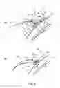 Fig. 08 - Developing device