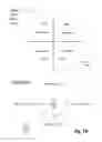 Fig. 13 - BLOOD TRACKING AND DELIVERY DEVICES AND METHODS