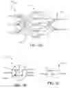 Fig. 02 - HIGH-DENSITY NEURAL NETWORK ARRAY