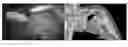 Fig. 01 - APPARATUS AND METHOD FOR REGISTERING PRE-OPERATIVE IMAGE DATA WITH INTRA-OPERATIVE LAPAROSCOPIC ULTRASOUND IMAGES