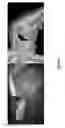 Fig. 03 - APPARATUS AND METHOD FOR REGISTERING PRE-OPERATIVE IMAGE DATA WITH INTRA-OPERATIVE LAPAROSCOPIC ULTRASOUND IMAGES