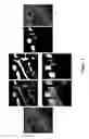 Fig. 04 - APPARATUS AND METHOD FOR REGISTERING PRE-OPERATIVE IMAGE DATA WITH INTRA-OPERATIVE LAPAROSCOPIC ULTRASOUND IMAGES