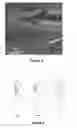 Fig. 06 - APPARATUS AND METHOD FOR REGISTERING PRE-OPERATIVE IMAGE DATA WITH INTRA-OPERATIVE LAPAROSCOPIC ULTRASOUND IMAGES