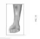 Fig. 23 - Image calibration for skin lesions